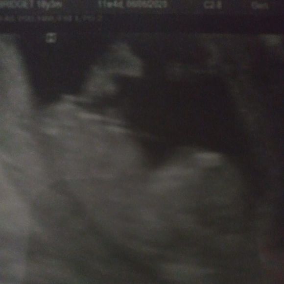 Meet your Posher, Patrick - Picture 1 of 1